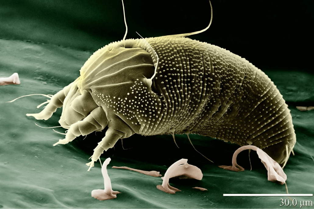 How To Use Vinegar To Kill Dust Mites