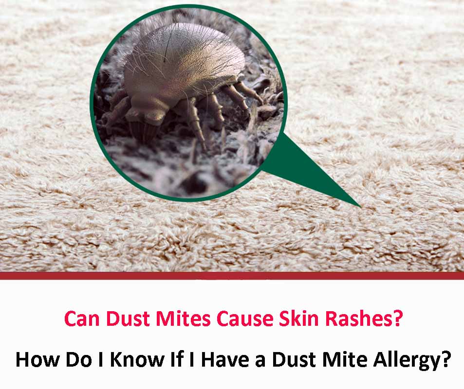 Can Dust Mites Cause Skin Rashes?
