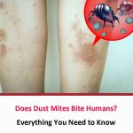 Does Dust Mites Bite Humans?