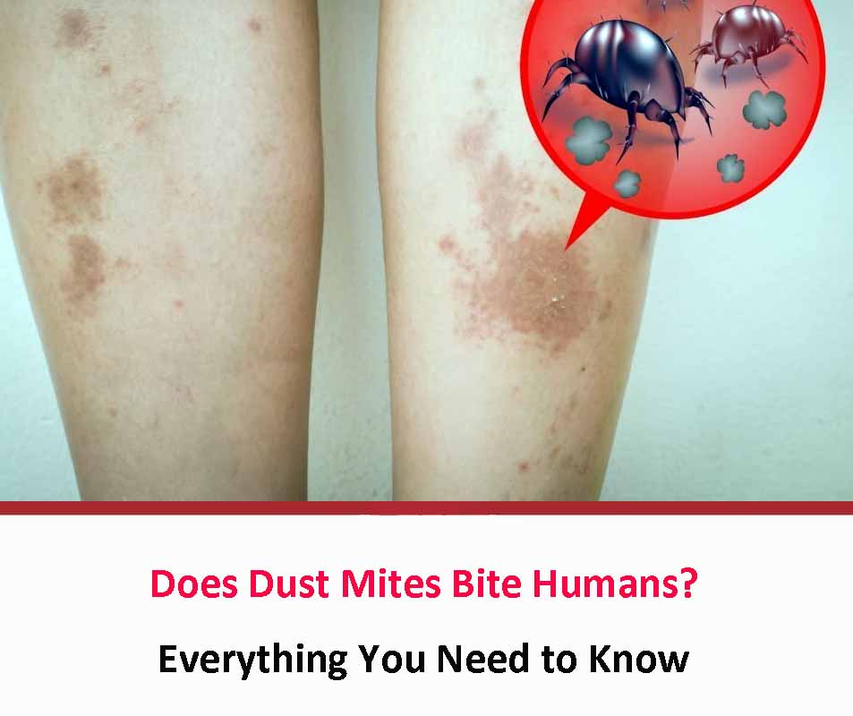 Does Dust Mites Bite Humans?