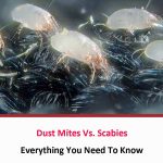Dust Mites Vs Scabies