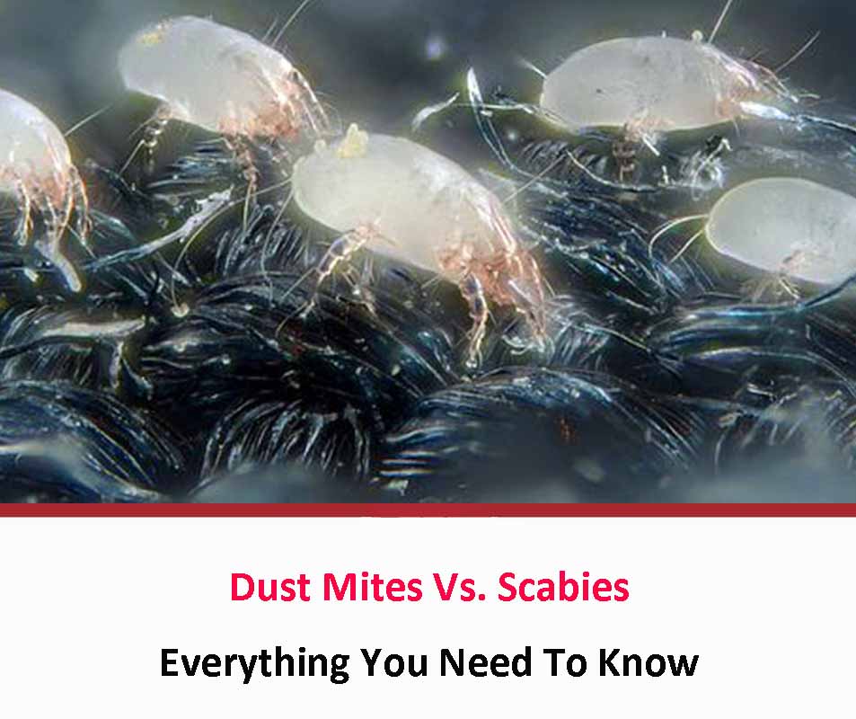 Dust Mites Vs Scabies